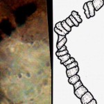 人間の髪に見えない目に見える目と空の目に見えない11種類の顕微鏡は、サイロンドルとヘビの両方の状態で保存されている微生物です。